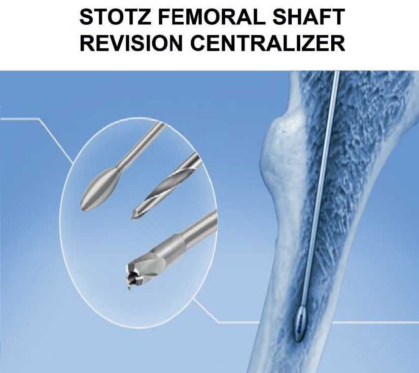 Femoral shaft revision centralizer